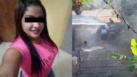 joven quemada