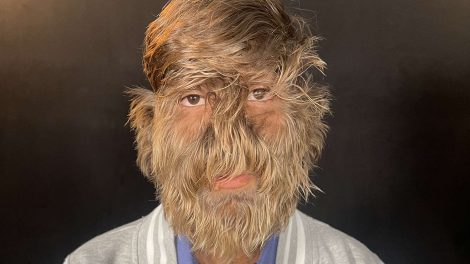 Lalit Patidar, hombre lobo