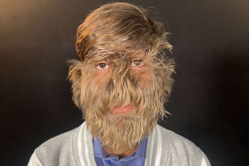 Lalit Patidar, hombre lobo